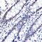 NFKB Inhibitor Alpha antibody, GTX03210, GeneTex, Immunohistochemistry paraffin image 