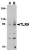 Toll Like Receptor 9 antibody, A00198-1, Boster Biological Technology, Western Blot image 