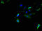Alpha-Methylacyl-CoA Racemase antibody, LS-C498379, Lifespan Biosciences, Immunofluorescence image 