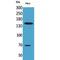 Glycoprotein Ib Platelet Subunit Alpha antibody, LS-C387155, Lifespan Biosciences, Western Blot image 