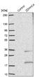 Zinc Finger DHHC-Type Containing 4 antibody, NBP1-83858, Novus Biologicals, Western Blot image 
