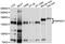 Alpha-mannosidase 2 antibody, PA5-76526, Invitrogen Antibodies, Western Blot image 