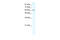 Methyltransferase Like 3 antibody, 28-137, ProSci, Western Blot image 