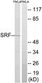 Serum Response Factor antibody, LS-C199605, Lifespan Biosciences, Western Blot image 