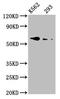 Bone Morphogenetic Protein Receptor Type 1A antibody, LS-C369335, Lifespan Biosciences, Western Blot image 