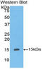 Inhibin Subunit Beta A antibody, LS-C294606, Lifespan Biosciences, Western Blot image 