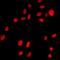 Zinc Finger E-Box Binding Homeobox 1 antibody, orb412362, Biorbyt, Immunocytochemistry image 