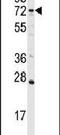 DGK-alpha antibody, PA5-15418, Invitrogen Antibodies, Western Blot image 