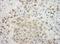 EYA Transcriptional Coactivator And Phosphatase 4 antibody, NBP1-41100, Novus Biologicals, Immunohistochemistry paraffin image 