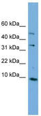 Solute Carrier Family 25 Member 13 antibody, TA344804, Origene, Western Blot image 