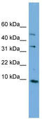 Calcium-binding mitochondrial carrier protein Aralar2 antibody, TA344804, Origene, Western Blot image 