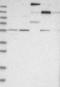 Integrin Subunit Alpha 2b antibody, NBP1-84579, Novus Biologicals, Western Blot image 