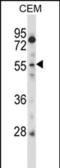 Cysteine And Serine Rich Nuclear Protein 2 antibody, PA5-35134, Invitrogen Antibodies, Western Blot image 