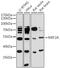 Myocyte Enhancer Factor 2A antibody, LS-C747263, Lifespan Biosciences, Western Blot image 