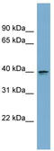 Aspartate Beta-Hydroxylase Domain Containing 2 antibody, TA344780, Origene, Western Blot image 