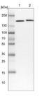 Structural Maintenance Of Chromosomes 4 antibody, NBP1-86635, Novus Biologicals, Western Blot image 