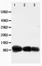 C-X-C Motif Chemokine Ligand 10 antibody, PA5-79103, Invitrogen Antibodies, Western Blot image 