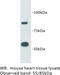 Transmembrane protein 2 antibody, MBS355112, MyBioSource, Western Blot image 