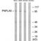 Patatin Like Phospholipase Domain Containing 8 antibody, PA5-49993, Invitrogen Antibodies, Western Blot image 