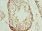 Nucleoporin 43 antibody, LS-C397718, Lifespan Biosciences, Immunohistochemistry paraffin image 