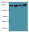 DExD-Box Helicase 50 antibody, A58754-100, Epigentek, Western Blot image 