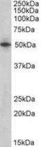 Septin-4 antibody, NBP1-52095, Novus Biologicals, Western Blot image 