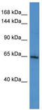 SIK Family Kinase 3 antibody, TA335451, Origene, Western Blot image 