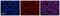 Solute Carrier Family 25 Member 11 antibody, NBP1-59597, Novus Biologicals, Immunohistochemistry paraffin image 