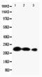 Lipocalin 2 antibody, PA5-79592, Invitrogen Antibodies, Western Blot image 