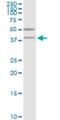 Vesicle Amine Transport 1 antibody, H00010493-M07, Novus Biologicals, Western Blot image 