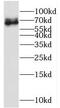 Membrane Palmitoylated Protein 7 antibody, FNab05291, FineTest, Western Blot image 