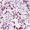 Tumor Protein P53 Binding Protein 1 antibody, NBP2-25028, Novus Biologicals, Immunohistochemistry paraffin image 