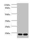 Ribosomal Protein S13 antibody, LS-C211201, Lifespan Biosciences, Western Blot image 