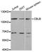 Cbl Proto-Oncogene B antibody, MBS127196, MyBioSource, Western Blot image 