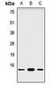 NADH:Ubiquinone Oxidoreductase Subunit A6 antibody, LS-C668162, Lifespan Biosciences, Western Blot image 