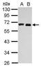 Hyaluronan Synthase 3 antibody, GTX114465, GeneTex, Western Blot image 