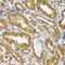 Matrix Metallopeptidase 14 antibody, 18-703, ProSci, Immunohistochemistry paraffin image 