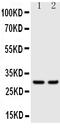 Kallikrein 1 antibody, PA1633, Boster Biological Technology, Western Blot image 