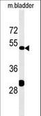 Kinesin light chain 3 antibody, LS-C165546, Lifespan Biosciences, Western Blot image 