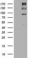 ALK Receptor Tyrosine Kinase antibody, TA801296AM, Origene, Western Blot image 