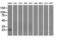 Proteasome 26S Subunit, Non-ATPase 10 antibody, LS-C114857, Lifespan Biosciences, Western Blot image 