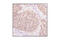 Small Ubiquitin Like Modifier 1 antibody, 4930S, Cell Signaling Technology, Immunohistochemistry paraffin image 