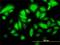 Keratin 17 antibody, H00003872-M01, Novus Biologicals, Immunofluorescence image 