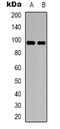 Dimethylglycine Dehydrogenase antibody, LS-C368698, Lifespan Biosciences, Western Blot image 