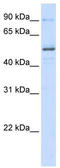 Zinc Finger Protein 275 antibody, TA339864, Origene, Western Blot image 