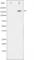 Rho Associated Coiled-Coil Containing Protein Kinase 2 antibody, abx011856, Abbexa, Western Blot image 