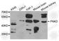 PNKD Metallo-Beta-Lactamase Domain Containing antibody, A8203, ABclonal Technology, Western Blot image 