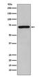 RELB Proto-Oncogene, NF-KB Subunit antibody, M00836, Boster Biological Technology, Western Blot image 