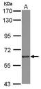 Eukaryotic Translation Initiation Factor 2B Subunit Delta antibody, PA5-30292, Invitrogen Antibodies, Western Blot image 