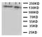 Aryl Hydrocarbon Receptor antibody, LS-C312928, Lifespan Biosciences, Western Blot image 